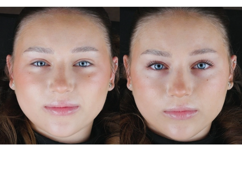 Rarity Lami Melt - Step 1 (5ml) 