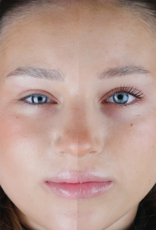 Lami Hydro Care - Step 3-4 saszetka 2ml RARITY