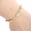 gold bracelet for a gold-plated leg