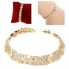 gold bracelet for a gold-plated leg