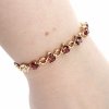 gold bracelet for a gold-plated leg