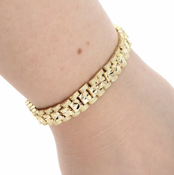 gold bracelet for a gold-plated leg