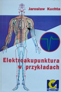 Jarosław Kuchta • Elektroakupunktura w przykładach
