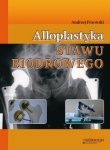 Alloplastyka stawu biodrowego /Górnicki