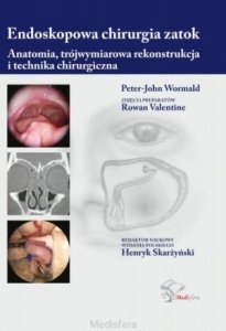 Endoskopowa chirurgia zatok Anatomia trójwymiarowa rekonstrukcja i technika chirurgiczna