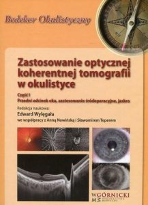 Zastosowanie optycznej koherentnej tomografii w okulistyce Część 1 Przedni odcinek oka, zastosowanie śródoperacyjne, jaskra