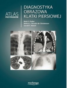 Diagnostyka obrazowa klatki piersiowej Atlas przypadków klinicznych