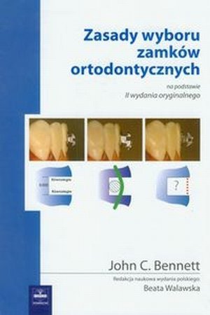 Zasady wyboru zamków ortodontycznych