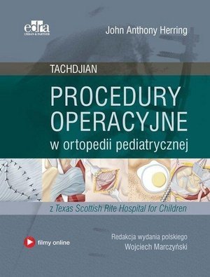 Procedury operacyjne w ortopedii pediatrycznej