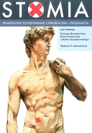 Stomia Prawidłowe postępowanie chirurgiczne i pielęgnacja