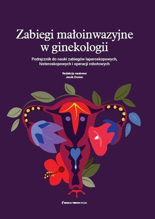 Zabiegi małoinwazyjne w ginekologii Podręcznik do nauki zabiegów laparoskopowych histeroskopowych i operacji robotowych