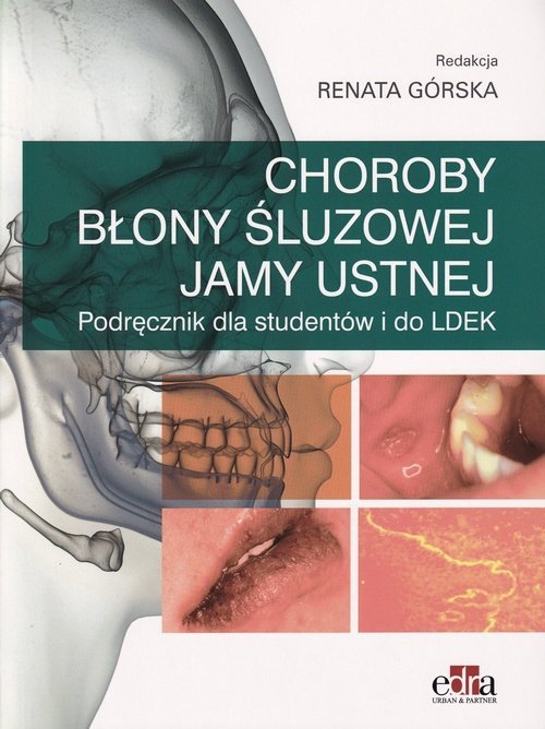Choroby błony śluzowej jamy ustnej Podręcznik dla studentów i do LDEK