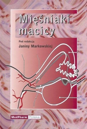 Mięśniaki Macicy