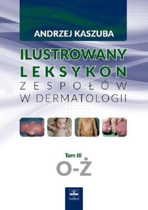 Ilustrowany leksykon zespołów w dermatologii Tom 3 O Ż