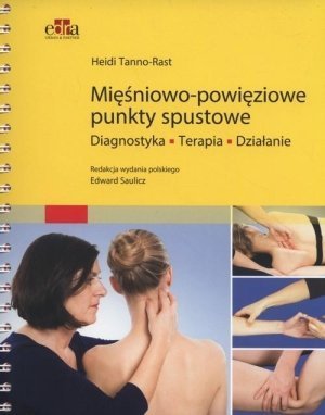 Mięśniowo powięziowe punkty spustowe Diagnostyka terapia działanie