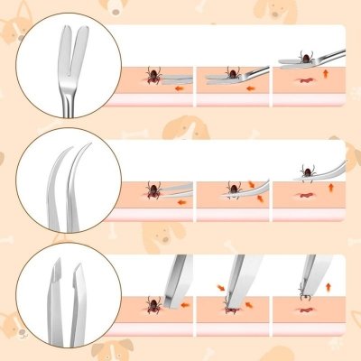 Zestaw do usuwania kleszczy XXL – 3 narzędzia + metalowe etui