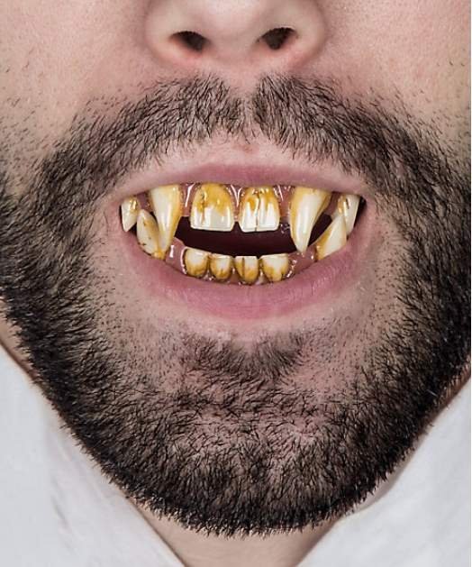 Sztuczne zęby - Mr. Hyde
