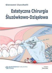 Estetyczna chirurgia śluzówkowo-dziąsłowa 