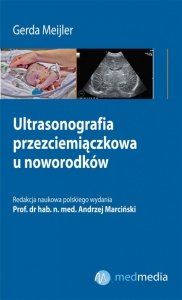 Ultrasonografia przezciemiączkowa u noworodków