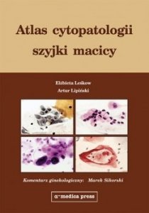 Atlas cytopatologii szyjki macicy