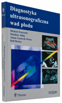 Diagnostyka ultrasonograficzna wad płodu