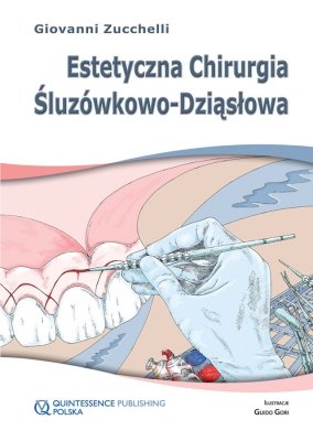Estetyczna chirurgia śluzówkowo-dziąsłowa 