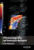 Ultrasonografia żył kończyn dolnych 