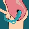 Stymulator angelo male prostate triple stimulation (blue)