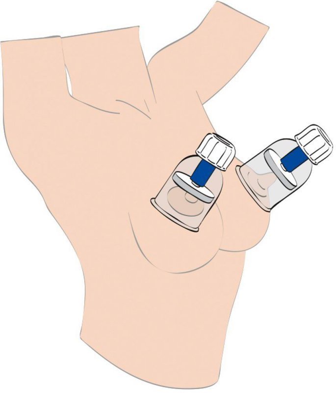 Max twist nipple sucker XL
