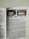 Zarys współczesnej ortodoncji Podręcznik dla studentów