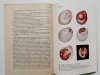 OTOLARYNGOLOGIA - Stanisław Iwankiewicz