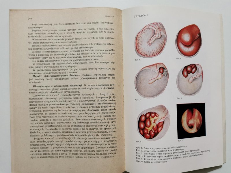 OTOLARYNGOLOGIA - Stanisław Iwankiewicz