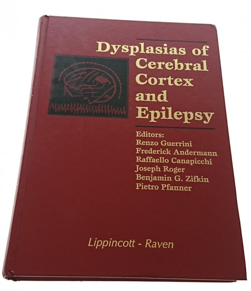 DYSPLASIS OF CEREBRAL CORTEX AND EPILEPSY 1996