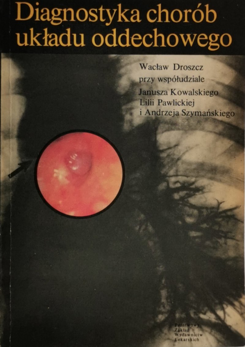 DIAGNOSTYKA CHORÓB UKŁADU ODDECHOWEGO - Wacław Droszcz