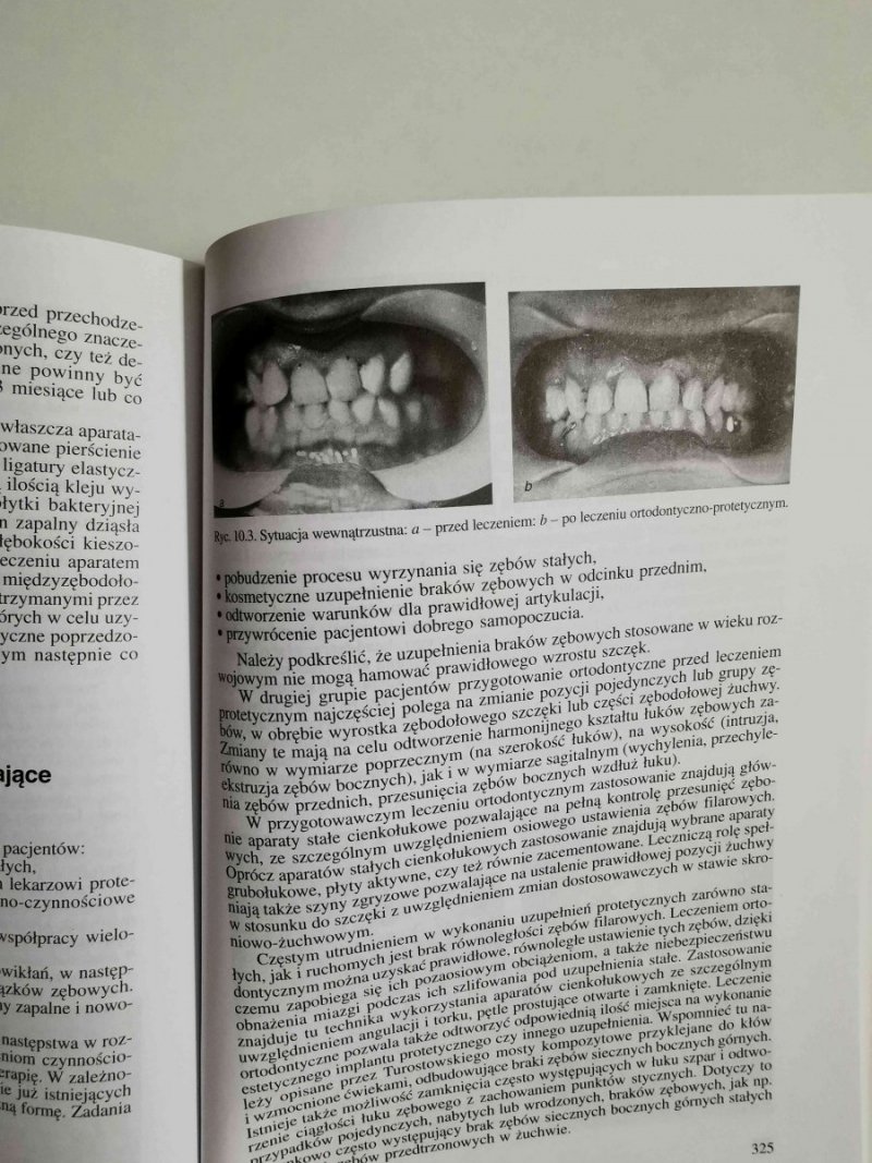 Zarys współczesnej ortodoncji Podręcznik dla studentów