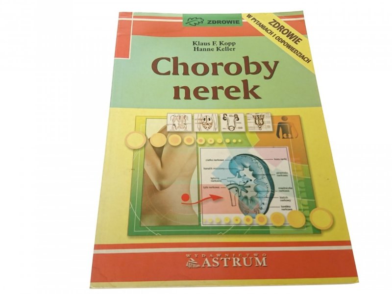 CHOROBY NEREK - Klaus F. Kopp 1997