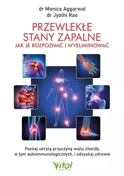 Przewlekłe stany zapalne – jak je rozpoznać i wyeliminować Poznaj ukrytą przyczynę wielu chorób, w tym autoimmunologicznych, i odzyskaj zdrowie